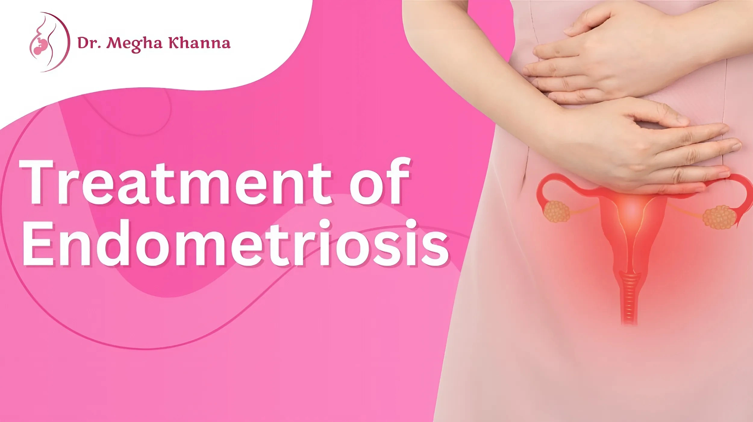 treatment of endometriosis in Kolkata